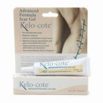 Kelo-cote Keloid Treatment Review 615