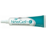 NewGel Advanced Silicone Gel For Scars Review 615