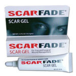 ScarFade Scar Cream And Gel Review 615