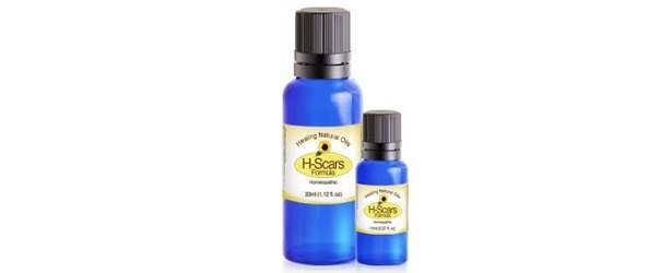 H-Scars Product Review